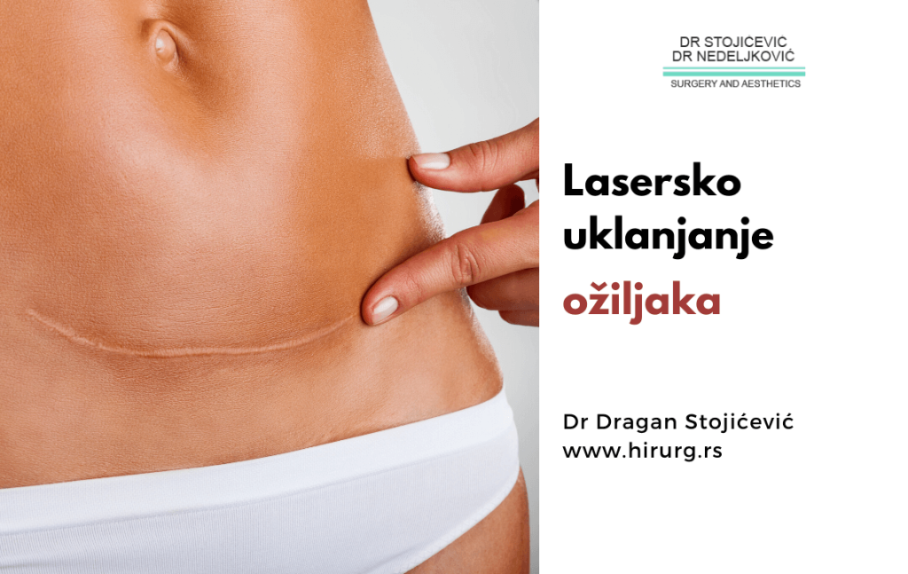 lasersko uklanjanje ožiljaka