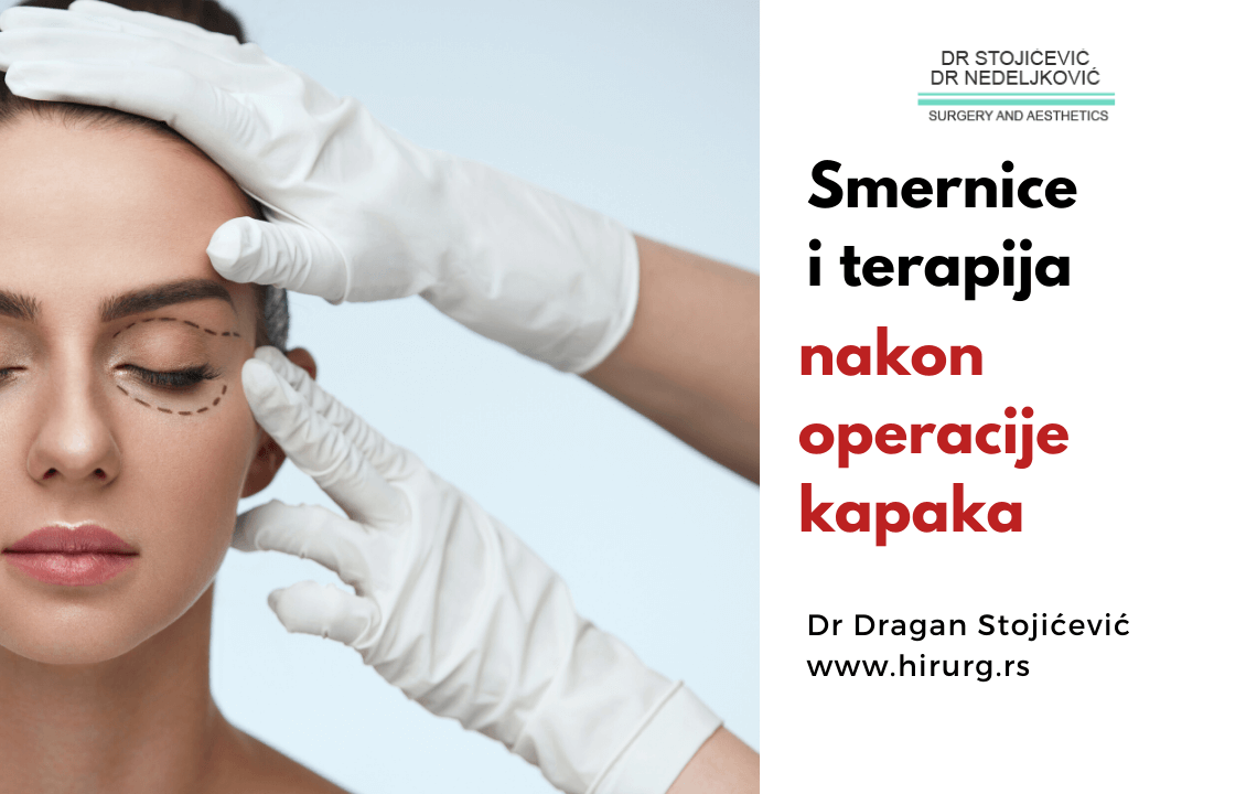 Oporavak nakon operacije kapaka