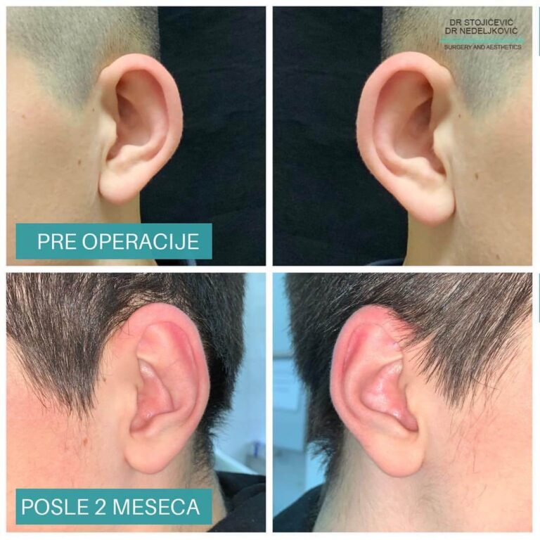 Operacija klempavih ušiju 5