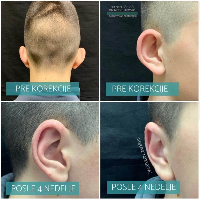 Operacija klempavih ušiju 6
