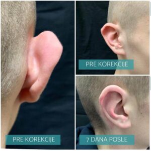 Operacija klempavih ušiju 7