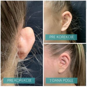 Operacija klempavih ušiju 8