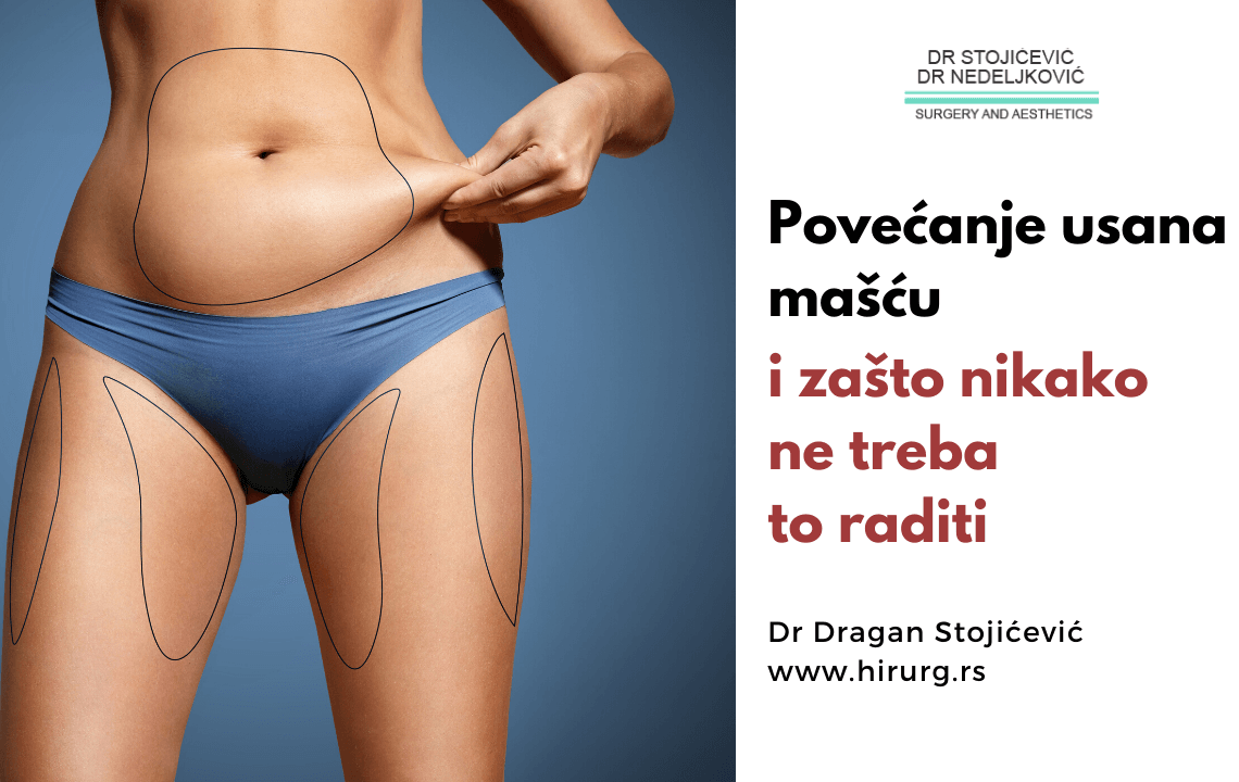 Povećanje usana mašću