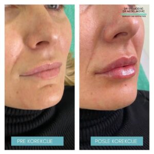 Lips dont lie 12
