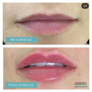 Lips dont lie 11