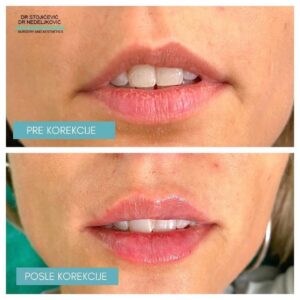 Lips dont lie 10