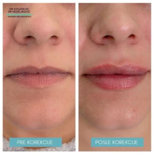 Lips dont lie 9