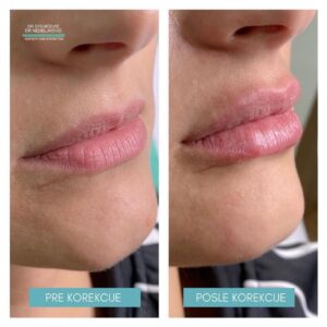 Lips dont lie 6