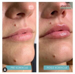 Lips dont lie 5