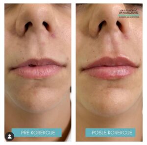 Lips dont lie 4