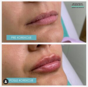 Lips dont lie 3