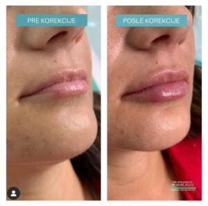 Lips dont lie