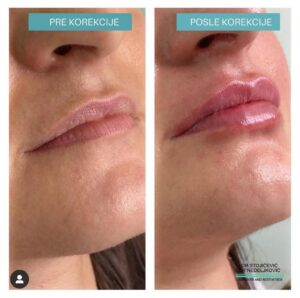 Lips dont lie 2