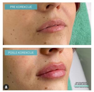 Lips dont lie 13