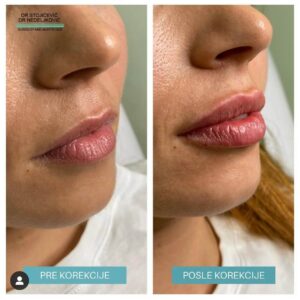 Lips dont lie 16