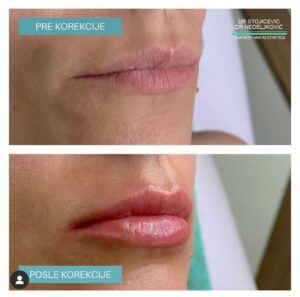Lips dont lie 15