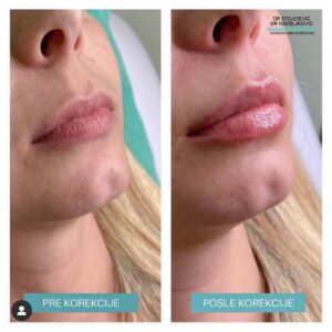 Lips dont lie 16
