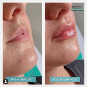 Lips dont lie 17