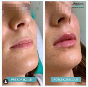 Lips dont lie 18