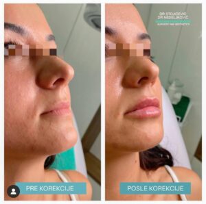 Lips dont lie 19