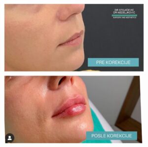 Lips dont lie 20