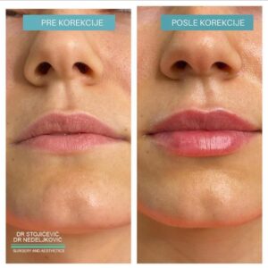 Lips dont lie 21