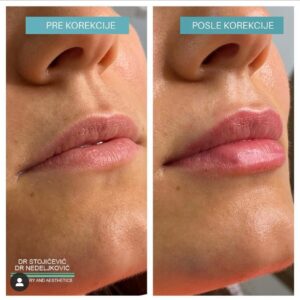 Lips dont lie 22