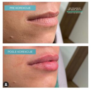 Lips dont lie 23
