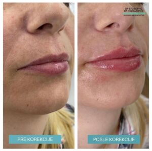 Lips dont lie 24
