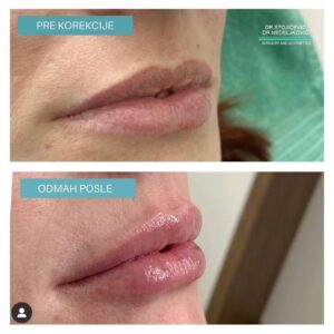 Lips dont lie 25