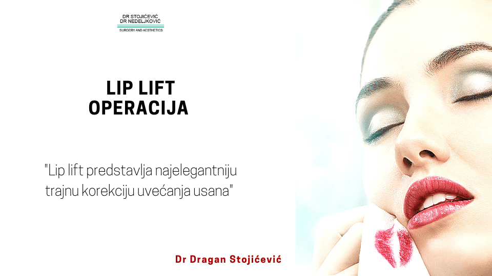 lip lift operacija 2