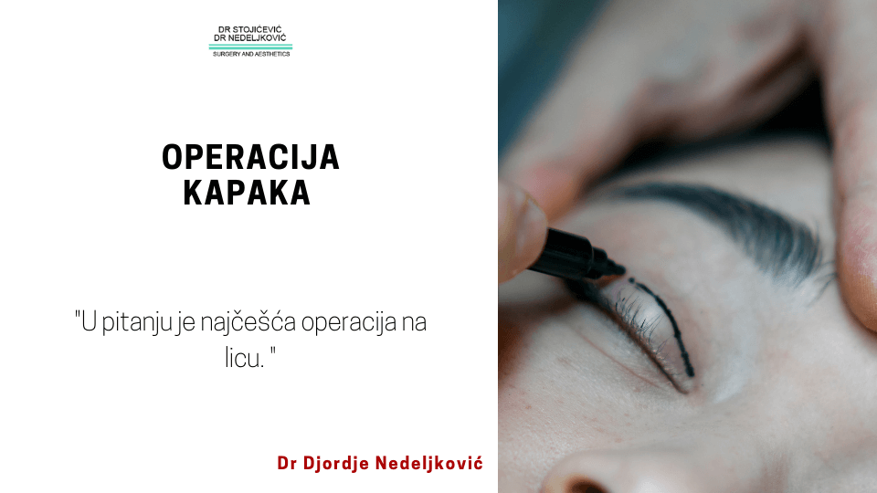 Blefaroplastika